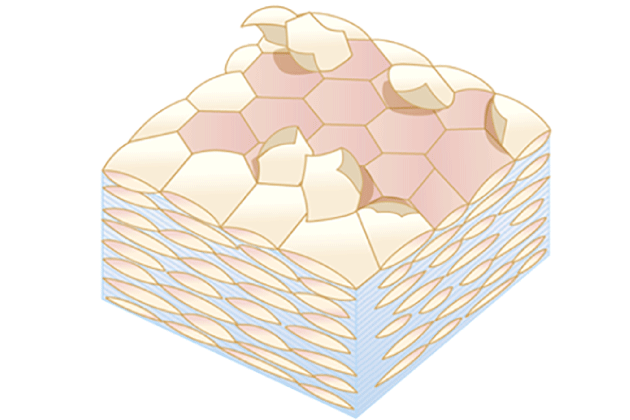 乾いて未熟な角質が積み重なった角質層