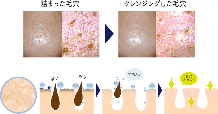 毛穴ケアならw洗顔不要のクレンジング モイストゲルクレンジング リ ダーマラボ Re Dermalab公式通販サイト